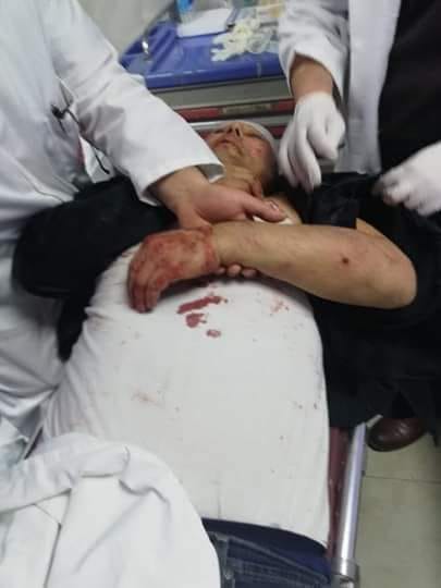 النضال الشعبي تستنكر اعتداء ميليشيا حماس على عاطف أبوسيف النضال الشعبي تستنكر اعتداء ميليشيا حماس على عاطف أبوسيف