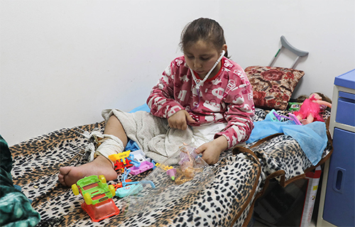 بتر الأطراف.. مأساة تطارد أطفال غزة بتر الأطراف.. مأساة تطارد أطفال غزة