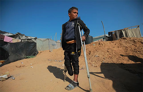 غزة: أطفال مبتورو الأطراف يواجهون أزمات نفسية ويتمنون الموت غزة: أطفال مبتورو الأطراف يواجهون أزمات نفسية ويتمنون الموت