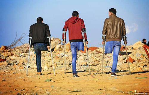 مبتورو الأطراف في غزة.. لا رعاية ولا أمل مع استمرار الحرب والحصار