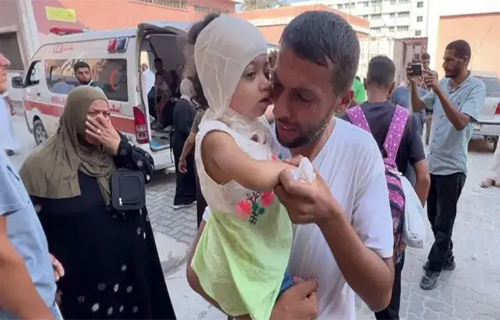 أطفال غزة.. أكثر الجرحى الذين تعرضوا للحروق نتيجة القصف