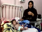 وفاة رضيع نتيجة سوء التغذية في غزة