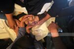 ارتفاع حصيلة الشهداء في قطاع غزة إلى 72,612 والإصابات إلى 172,457 منذ بدء العدوان